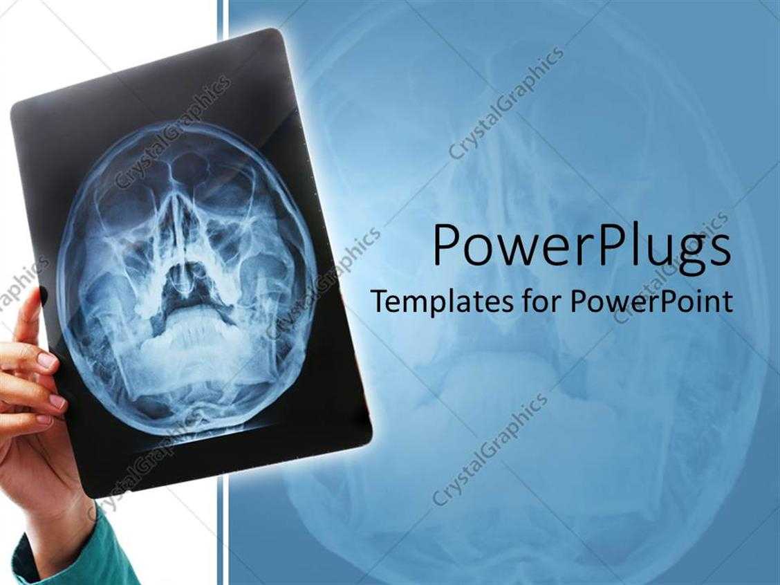 Powerpoint Template: Hand Holding Up X Ray Scan Of Human With Regard To Radiology Powerpoint Template